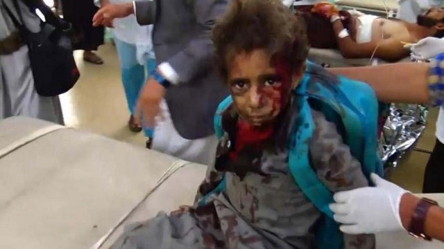 Dozens dead after school bus carrying children hit by airstrike in Yemen - Dainikshiksha